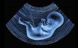 مجلس با اجباری شدن غربالگری در دوران بارداری مخالفت کرد
